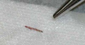 Implant